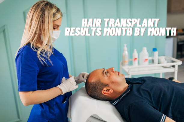 Hair transplant results month by month