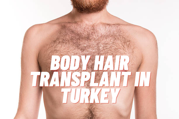 body hair transplant in Turkey
