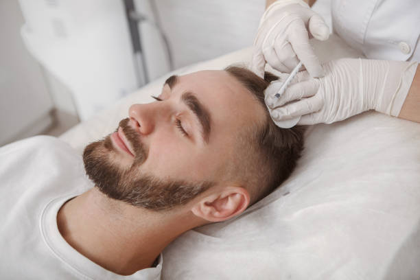 hair transplant after 1 month