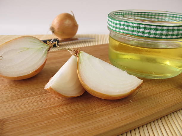 onion juice for baldness