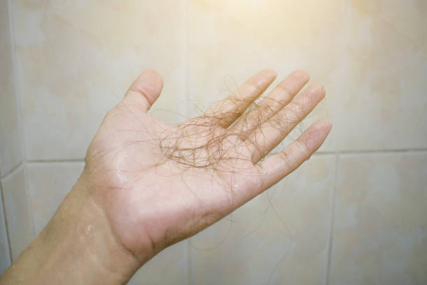 Diffuse hair thinning